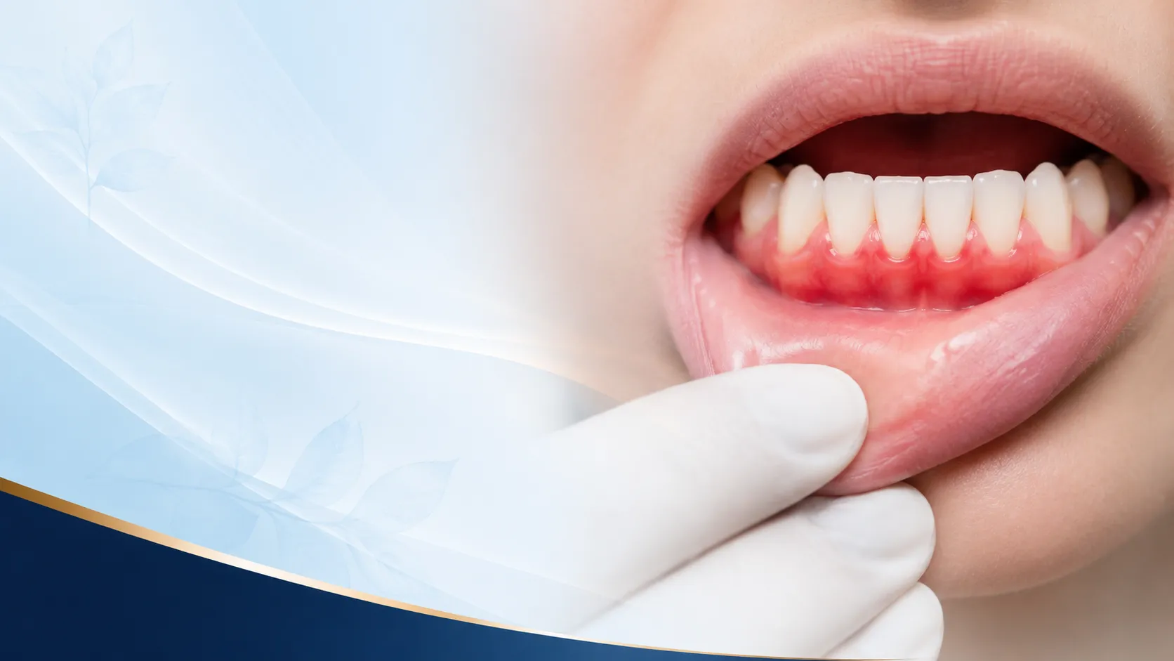 Periodontal Care