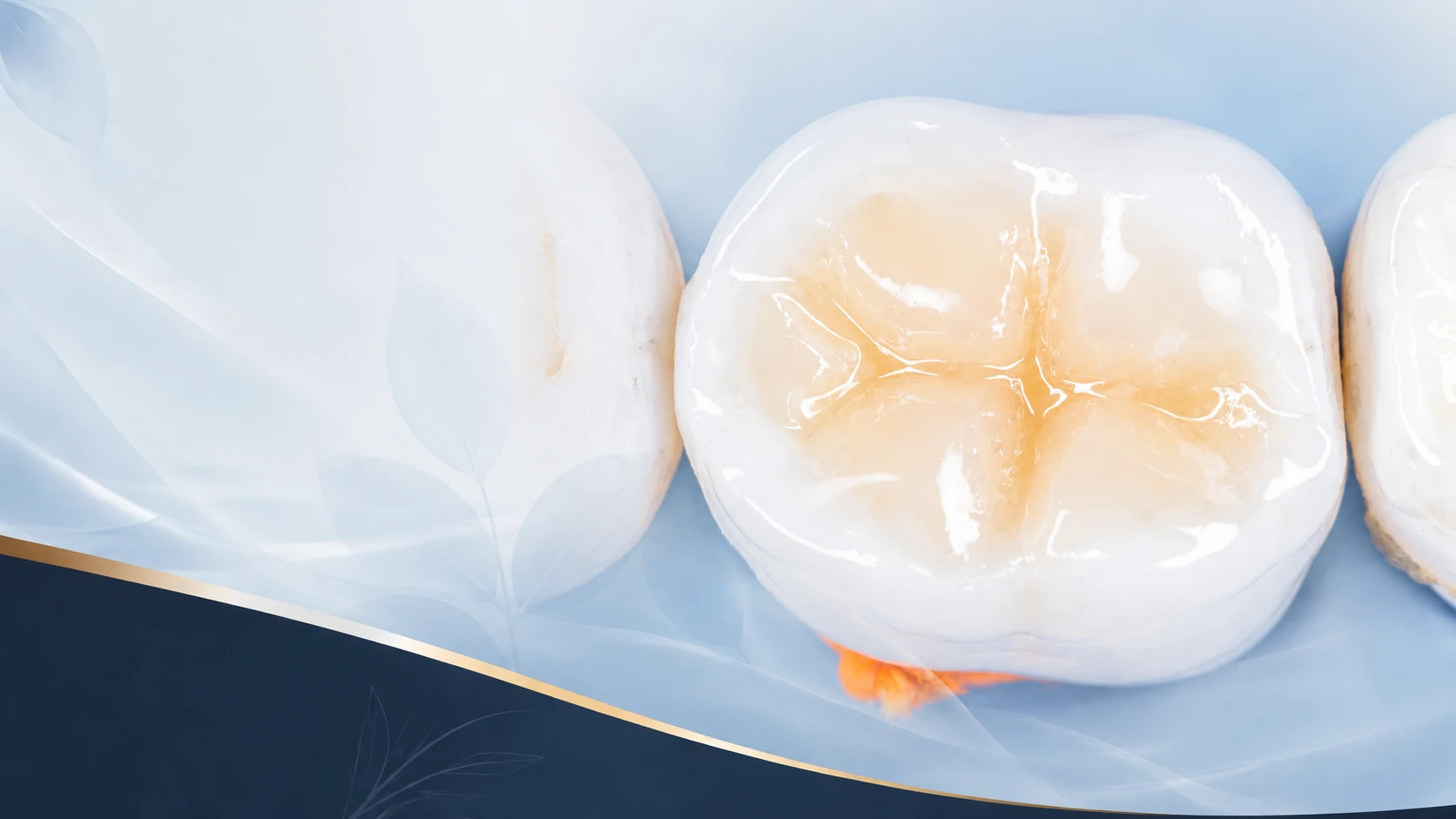 Sealants
